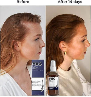 Feg Hairvital | 1 + 1 Gratis!